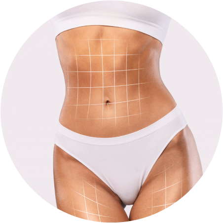 Hidrolipoclasia não aspirativa